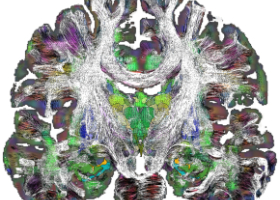 Une nouvelle cartographie du cerveau profond révèle les détails de son architecture
