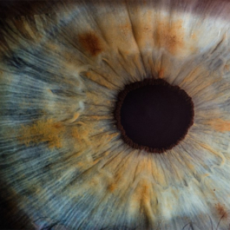 Un implant sous-rétinien restaure partiellement la vision de personnes atteintes de DMLA