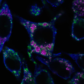 Image de macrophages (bleu) infectés par Brucella abortus (magenta) pendant 65 heures (microscopie confocale). © Suzana Salcedo