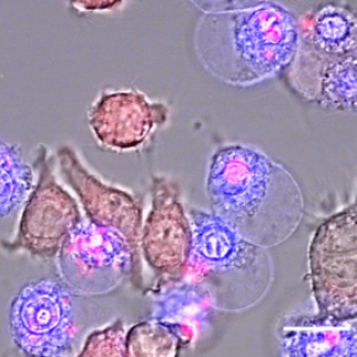 Inflammasome
