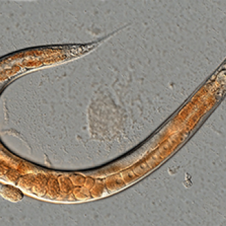 Nématode adulte, "Caenorhabditis elegans", visualisé au microscope plein champ à lumière transmise 