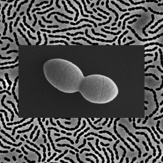 Streptococcus pneumoniae observée en microscopie à contraste de phase (arrière-plan) ; et zoom sur une seule cellule observée en microscopie électronique à balayage 