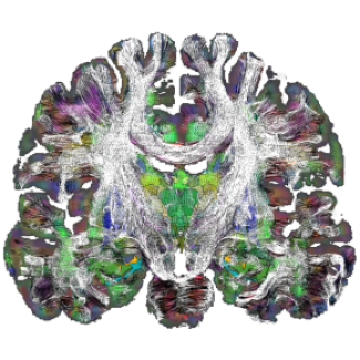 Une nouvelle cartographie du cerveau profond révèle les détails de son architecture