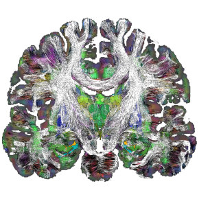 Une nouvelle cartographie du cerveau profond révèle les détails de son architecture
